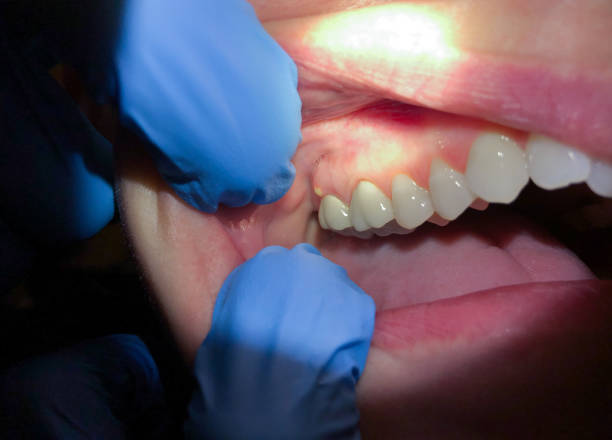 Best After-Hours Emergency Dentist in Parker, SC