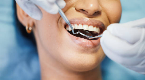 Best Weekend Emergency Dentist in Parker, SC
